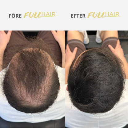 Fullhair V2 - Döljer omedelbart tunt hår